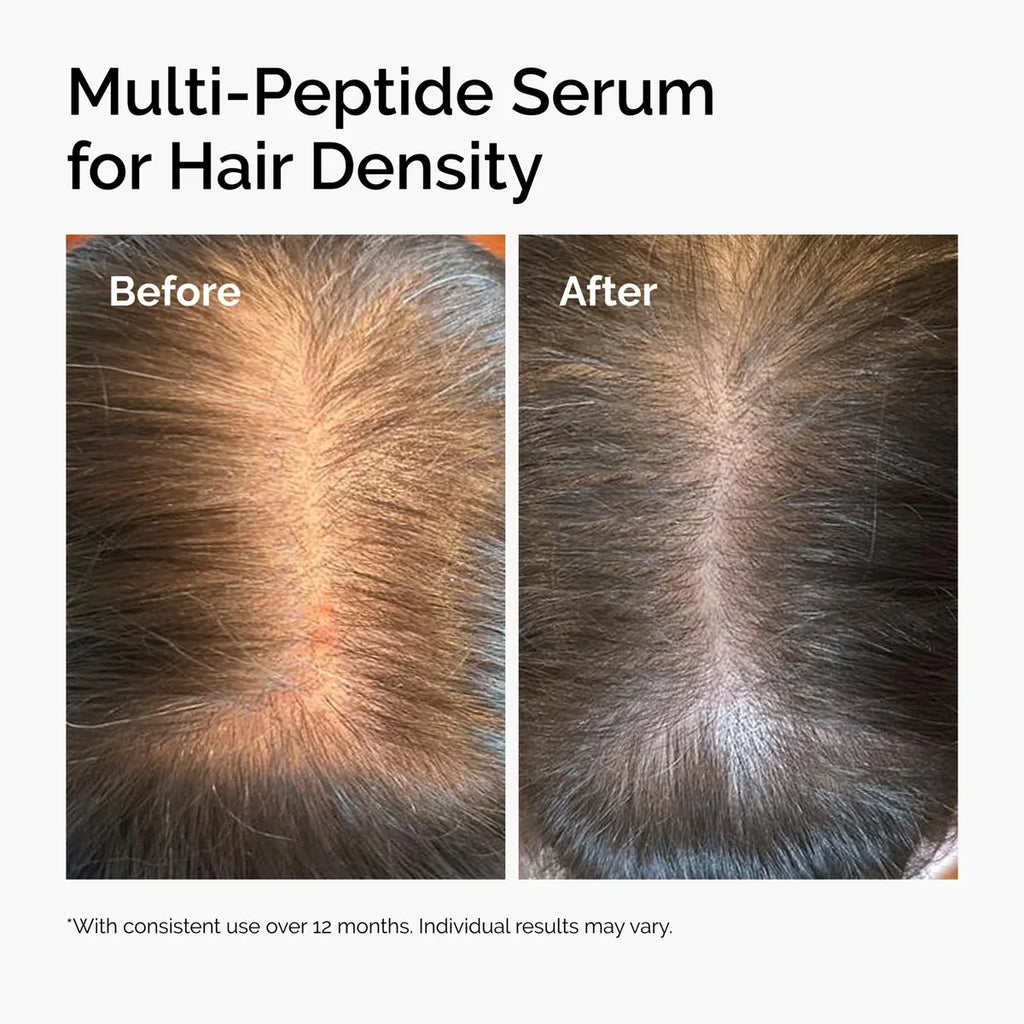 THE ORDINARY – Multi-Peptide Serum for Hair Density