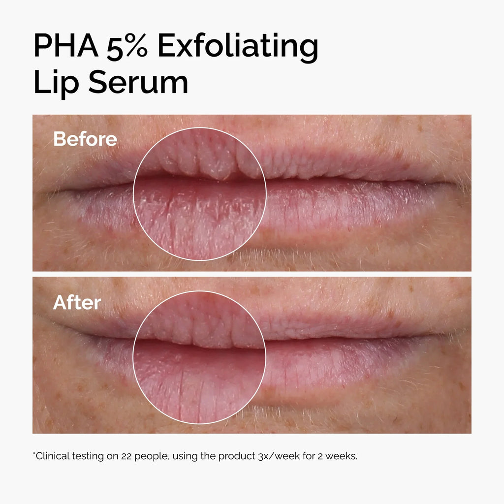 THE ORDINARY – PHA 5% Exfoliating Lip Serum