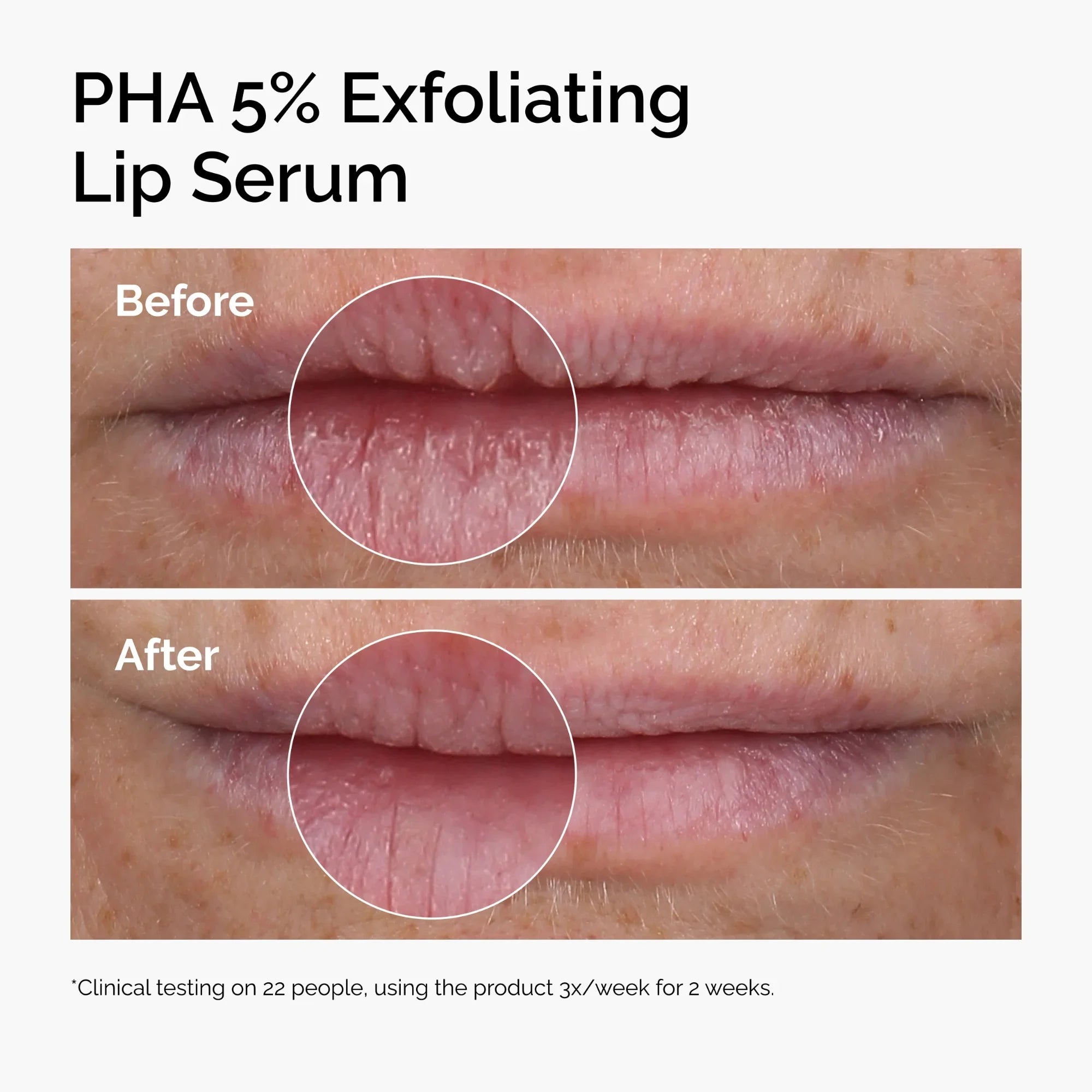 THE ORDINARY – PHA 5% Exfoliating Lip Serum