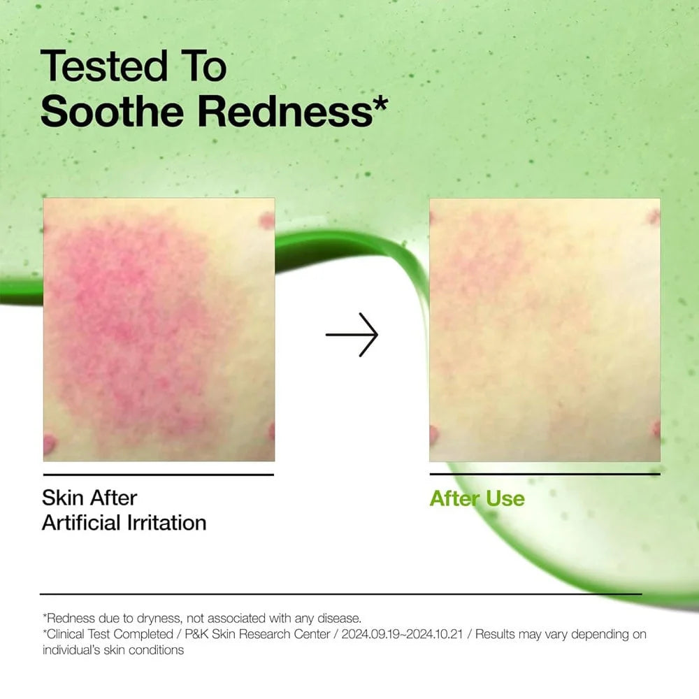 ANUA – Azelaic Acid 10 Hyaluron Redness Soothing Serum