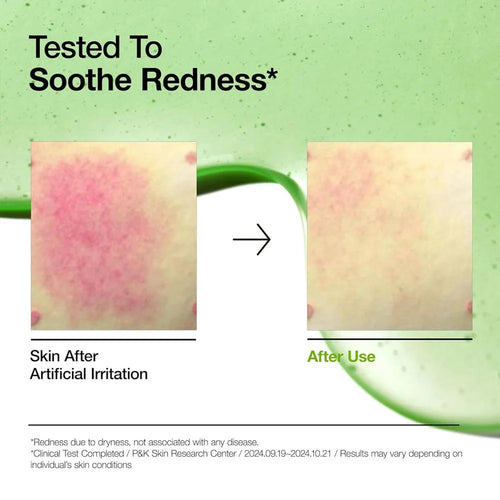ANUA – Azelaic Acid 10 Hyaluron Redness Soothing Serum