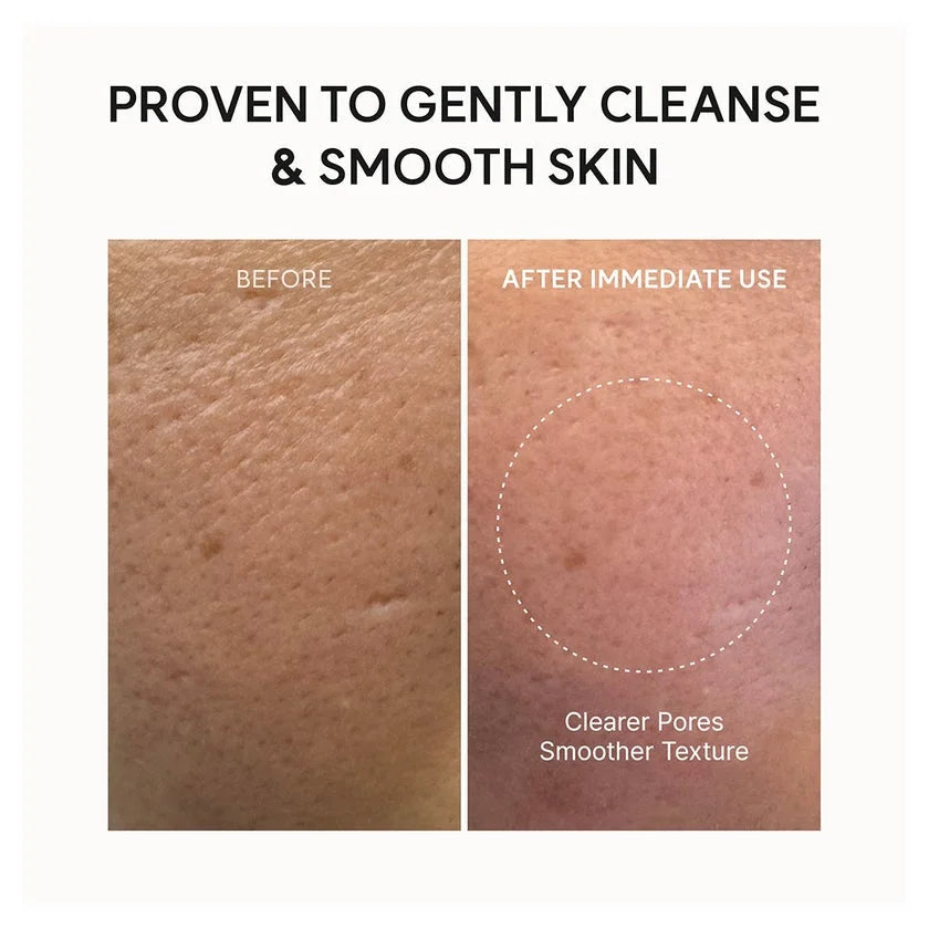 ARENCIA – Fresh Rosehip Rice Mochi Cleanser