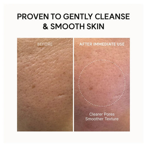 ARENCIA – Fresh Rosehip Rice Mochi Cleanser