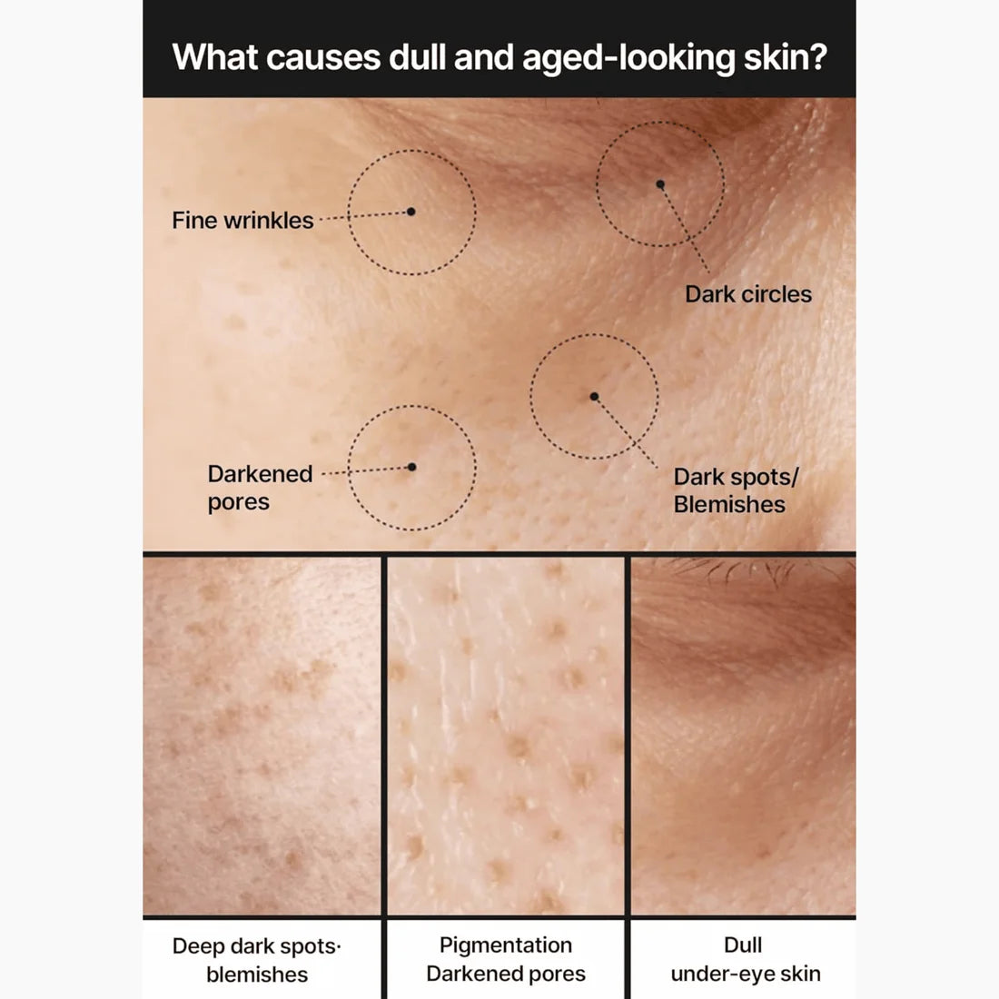 CELIMAX – Pore+Dark Spot Brightening Cream