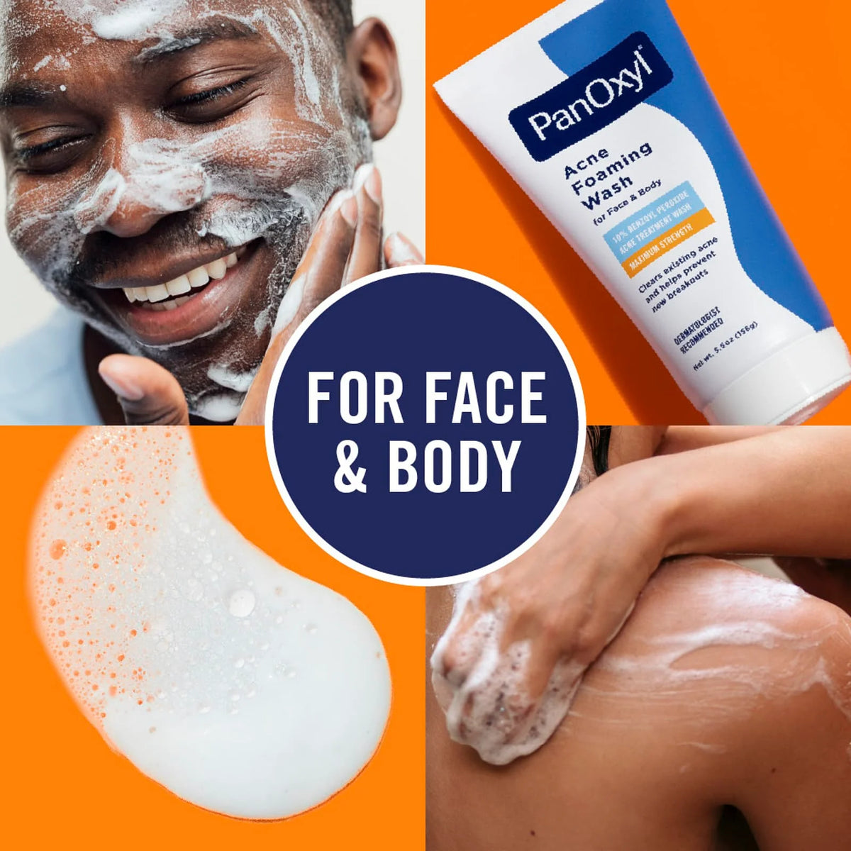 PANOXYL – Acne Foaming Wash (10% Benzoyl Peroxide)